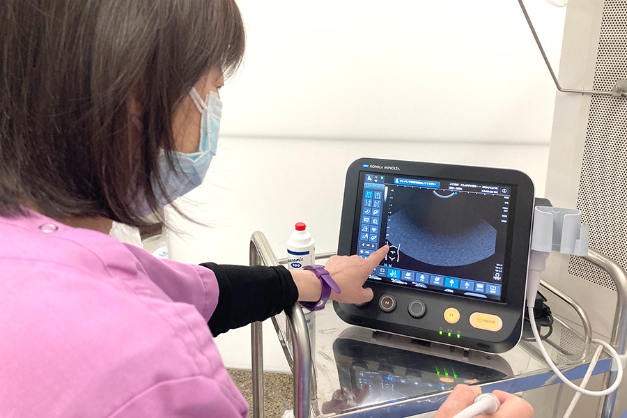 エコー検査機器